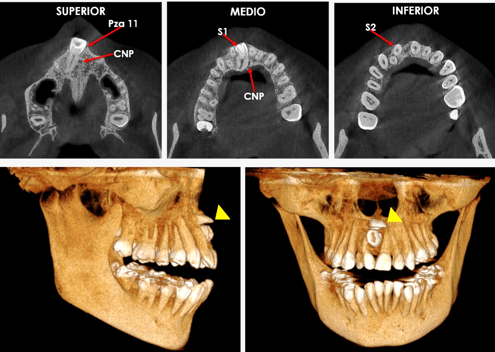 Tomografía dental